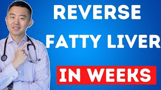 The FASTEST Way to Reverse Fatty Liver Naturally  NAFLD Treatment [upl. by Spatz]