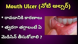 Mouth Ulcers Reasons and Treatment in Telugu [upl. by Anahoj]