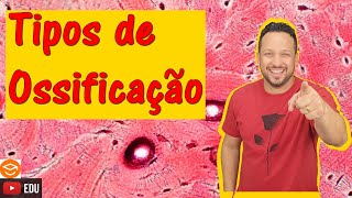 Tipos de Ossificação  Formação do Osso  Tecido Ósseo  Histologia Animal [upl. by Mcnutt679]