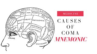 Causes of Coma  Detailed Overview [upl. by Ahoufe]