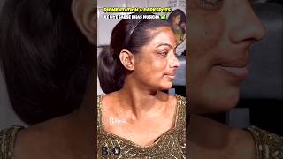 ✅How To Remove DARK SPOTS amp PIGMENTATION From Face Naturally shorts beautykadose [upl. by Yenobe417]