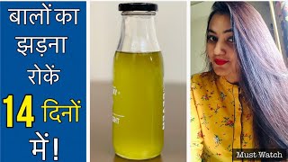 HAIR FALL  HAIR LOSS को सिर्फ 14 दिनों में जड़ से ठीक करें  Extreme Hair Loss Treatment At Home [upl. by Sherourd595]