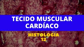 TECIDO MUSCULAR CARDÍACO  HISTOLOGIA 12 [upl. by Hsilgne]