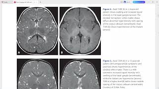 ultrasound radiologysonology [upl. by Erminia]