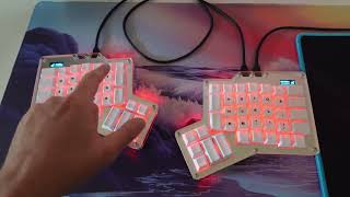 APOS  ErgoDox 76 Keyboard  Unboxing amp Setup [upl. by Finbur]