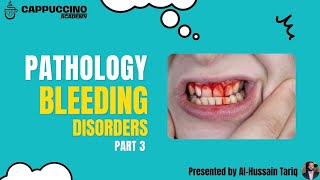 Bleeding Disorders Pathology Part3 [upl. by Inotna]