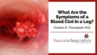 What Are the Symptoms of a Blood Clot in a Leg  Charles S Thompson MD FACS [upl. by Maximo41]