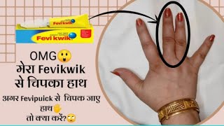 हाथ से fevikwik निकालने का सही तरीका  How to Remove Fevikwik from Skin at Home deepadilse [upl. by Soule990]