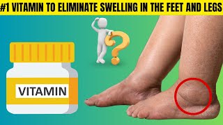 What vitamin is good to eliminate swelling in the legs and feet [upl. by Rasaec]