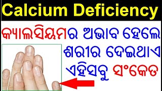 କ୍ୟାଲସିୟମ ଅଭାବ ର ଲକ୍ଷଣ  Calcium deficiency symptoms in Odia  Odia Health Tips [upl. by Lopez]