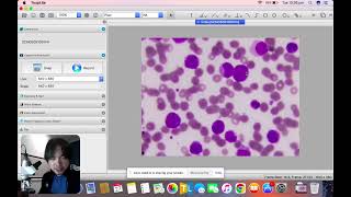 Early myeloid cells discussion part 1 [upl. by Wharton154]