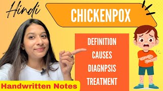 Chickenpox Explained in Hindi  Causes Signs amp Symptoms Diagnosis amp Treatment [upl. by Arrotal690]