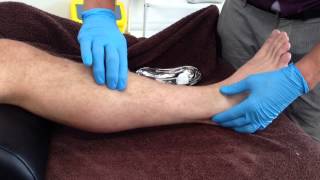 Dry Needling Extensor Digitorum Longus [upl. by Latsryk]