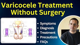 Varicocele  Symptoms Diagnostic Best Treatment FAQ  Dr Gaurav Gangwani IR [upl. by Prud]