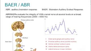 Natus EP Webinar Clinical Auditory Evoked Potentials [upl. by Ylliw]