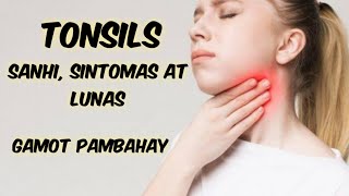 Gamot sa namamagang tonsil  gamot pambahay [upl. by Ahseinod]