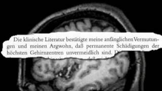 Verringerung der intellektuellen Fähigkeiten durch neuroleptische Behandlung [upl. by Akeme]