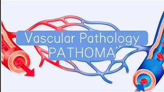 Vascular PATHOMA 4  Atherosclerosis [upl. by Treblah]