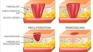 WOUND HEALING [upl. by Hildagarde]