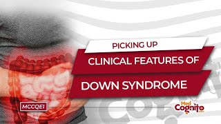 Picking Up Clinical Features of Down Syndrome  MCCQE1 [upl. by Alyt]