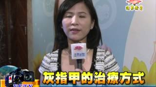 法界新聞》20150126灰指甲的治療方式 [upl. by Ssac133]