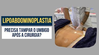 Precisa tampar o umbigo após a abdominoplastia  Dr Ricardo Drummond [upl. by Elleinnad]