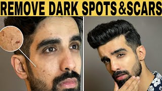 MY SKINCARE ROUTINE FOR DARK SPOTS amp SCARS ‼️ Simple and affordable [upl. by Romelle561]