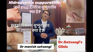 Hidradenitis suppurativaउपचार क्या है डॉक्टर को कब दिखाएंरोकथाम केलिए क्या करे DrManish Satsangi [upl. by Doak]