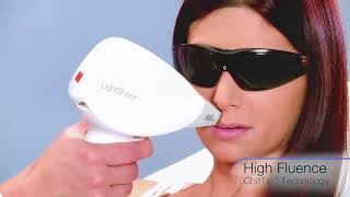 Lumenis LightSheer Desire Laser Hair Removal [upl. by Ahsehyt]