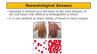 Haematological diseases  BPharm SEM II Pathophysiology by Manjushree Pawar [upl. by Nolahp]