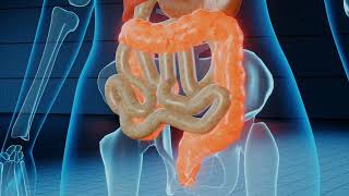 Durerea abdominala acută amp cauze simptome [upl. by Emerson]