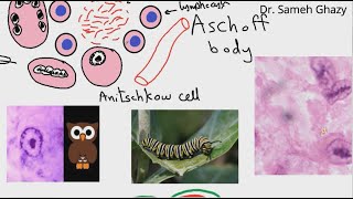 Systemic pathology 1  CVS rheumatic fever 1 الحمى الروماتيزمية DRSAMEH GHAZY [upl. by Ahsiekyt860]