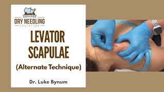 Dry Needling Levator Scapulae Alternate Technique [upl. by God513]