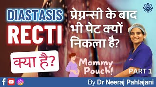 प्रेग्नन्सी के बाद भी पेट निकला हुआ What is Diastasis Recti Part 1  Dr Neeraj Pahlajani [upl. by Ian]