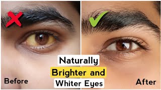 4 Tips to Get Brighter amp Whiter Eyes Get Rid of Yellow Eyes White Eyes How to have Attractive eye [upl. by Marcoux981]