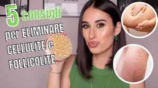 5 CONSIGLI PER ELIMINARE CELLULITE E FOLLICOLITE ❌ [upl. by Dyrrej]