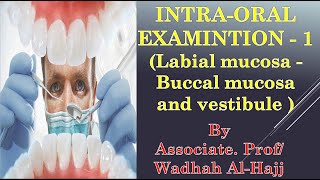 10Intraoral examination1 Labial buccal mucosa and vestibule–oral diagnosis lecturesدوضاح الحاج [upl. by Cathlene]