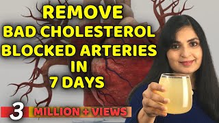 Remove Bad Cholesterol Naturally amp Reduce Clogged Arteries and Stroke  Samyuktha Diaries [upl. by Maurer145]