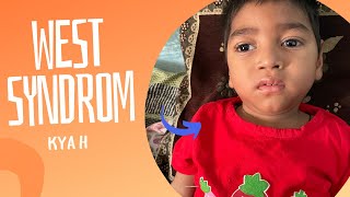 west syndrome baby video west syndrome kya hota hai in hindimysonLife [upl. by Shivers509]