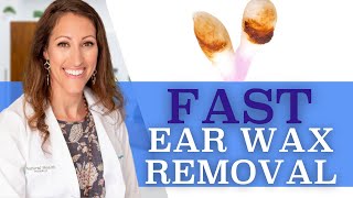 Clogged Ears  How to Remove Ear Wax At Home With Hydrogen Peroxide [upl. by Kutzenco488]