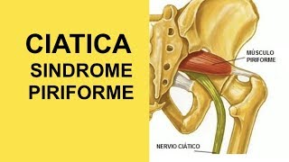 Nervio Ciatico Ejercicios Para Sindrome Piriforme y Ciatica [upl. by Anirod]