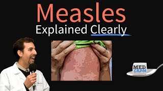 Measles rubeola Explained Clearly by MedCramcom [upl. by Nylaf]