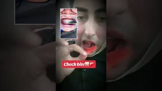 dentist comedy funny stitch dentistry shortsvideo teeth doctor 🦷🦷😊😊😊😊🪥✔️ [upl. by Zorah]