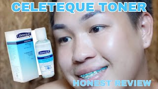 CELETEQUE HYDRATION TONER  HONEST REVIEW  EFFECTIVE NGA BA [upl. by Iloj942]