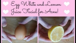 Egg White and Lemon Juice Facial for Acne How to Clear Acne Naturally ♥ [upl. by Gaul]