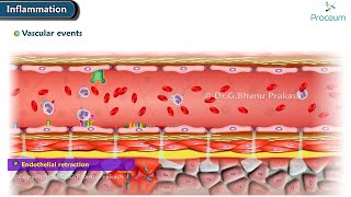 2 Acute Inflammation Vascular Events Animation [upl. by Nisaj878]