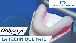 Orthocryl®  gouttière occlusale réalisée selon la technique pâte appareil dentaire [upl. by Rawdin]