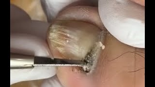 How to repair nails [upl. by Ynattir]