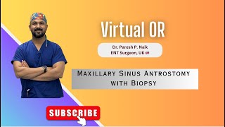 Maxillary Sinus Antrostomy with Biopsy in a bleeding field  UNEDITED VIDEO [upl. by Stark]