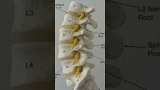 Lumbar spinal stenosis recovery without surgery sciatica lowerbackpain stenosis l4l5 l5s1 [upl. by Nreval]